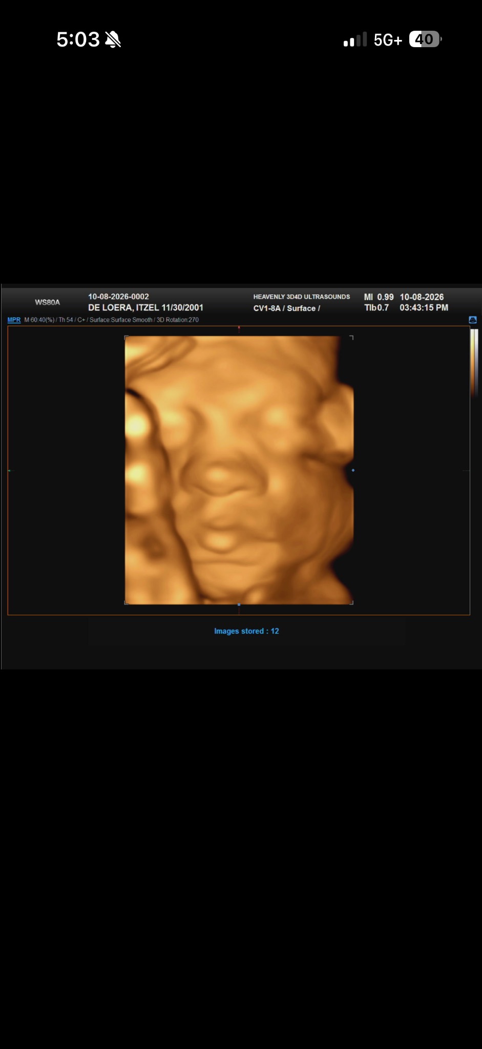 3D ultrasound of baby Elayna