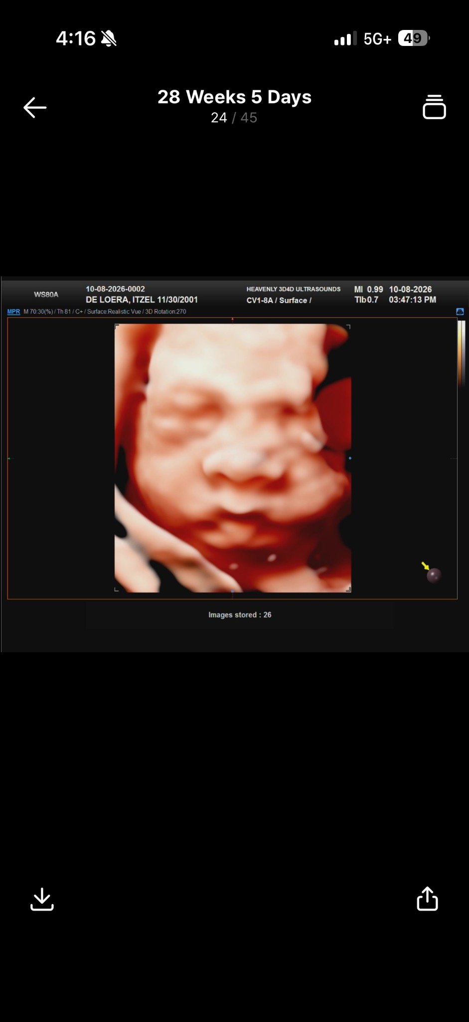 A second 3D ultrasound portrait of Elayna